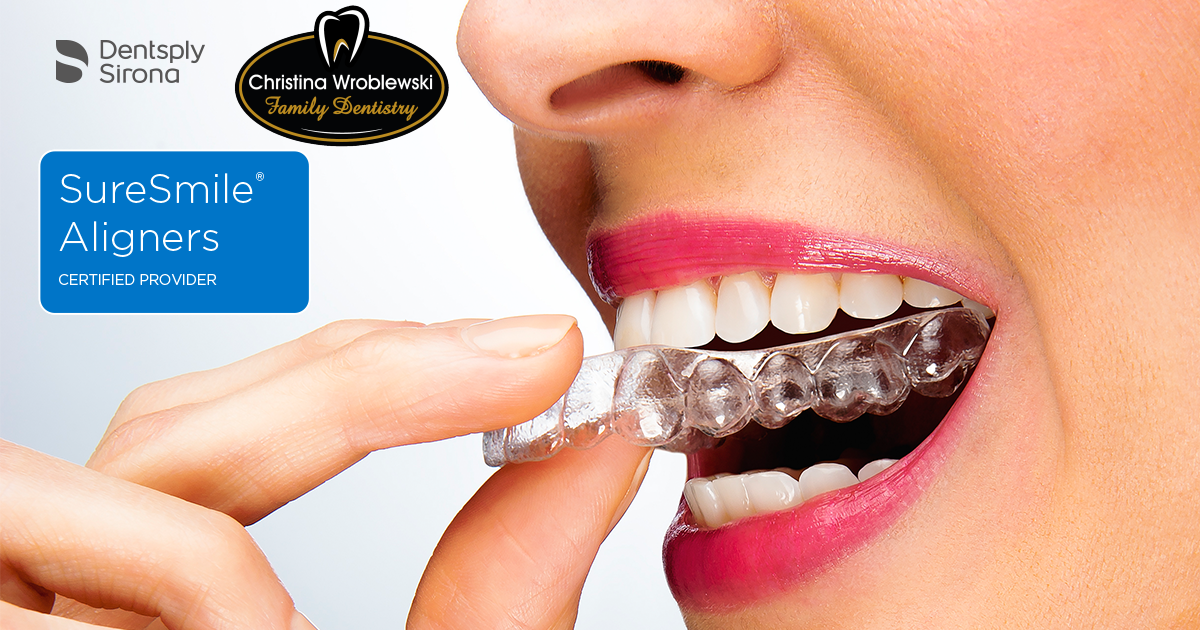 Sure Smile Aligners